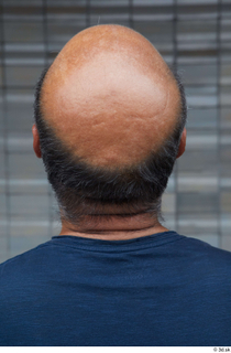 Street references  610 bald hair head 0002.jpg